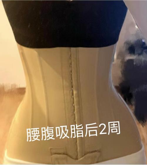 苏州双眼皮可选美贝尔_腰腹环吸苏州美贝尔_腰腹吸脂苏州对比